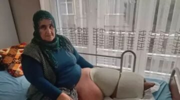 35 yıldır fil hastalığıyla mücadele ediyor