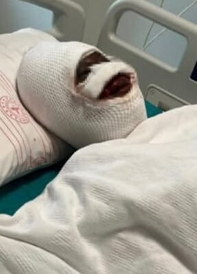 Gaziantep’te Eski Koca Vahşeti