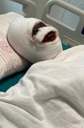 Gaziantep’te Eski Koca Vahşeti